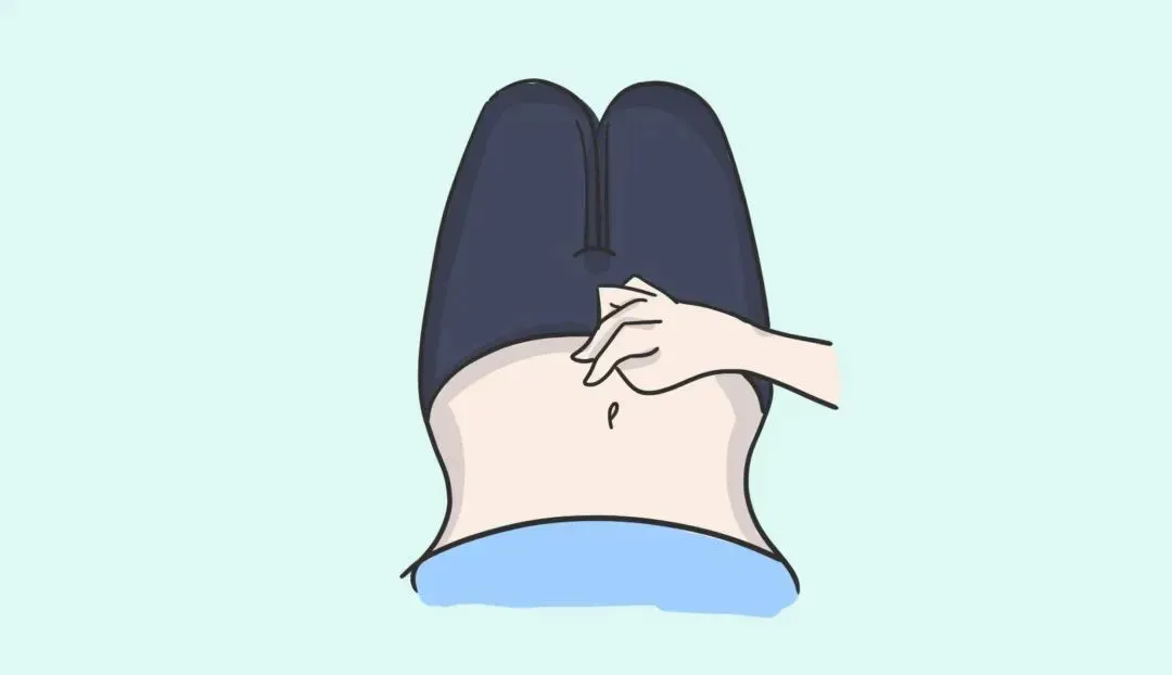 盆底修復4.png